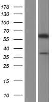 CECR6 Protein (Over-Expression Lysate Myc-DDK (Flag))
