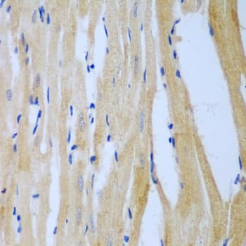 GNT-III / MGAT3 Antibody