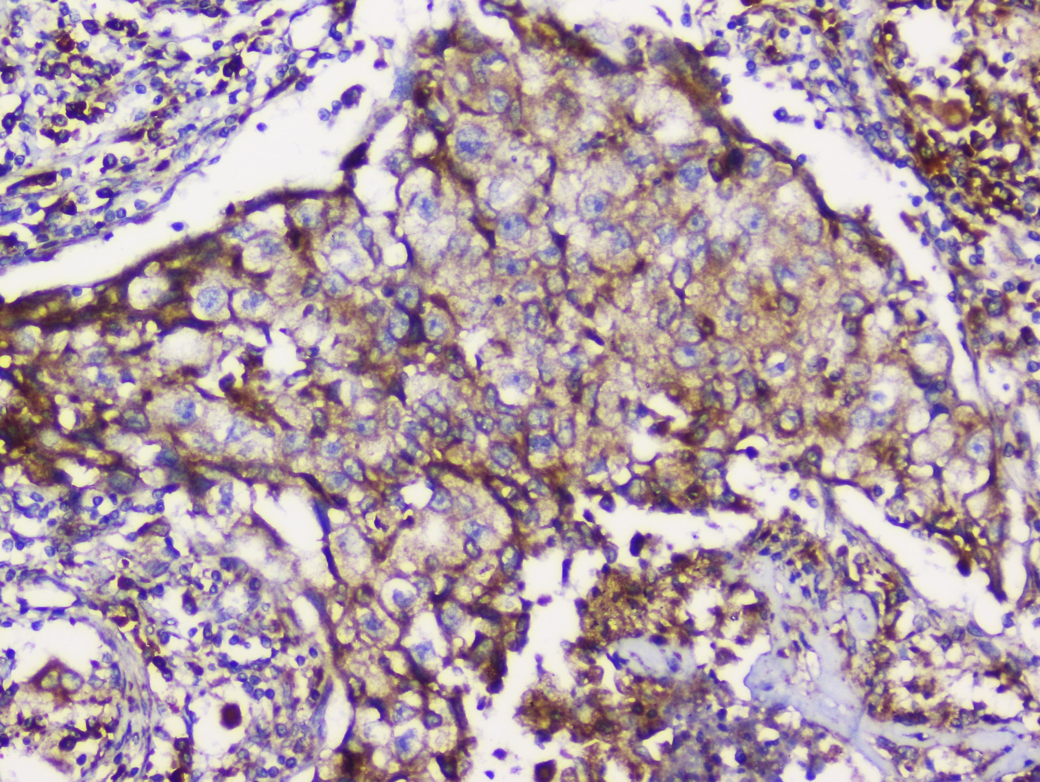 Polyclonal Rabbit anti-Human GRIK1 / GLUR5 Antibody (aa271-450, WB)