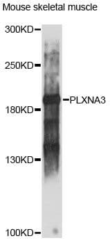 Polyclonal Rabbit anti-Human PLXNA3 / Plexin A3 Antibody (WB)