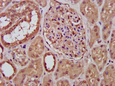 RFXANK Antibody