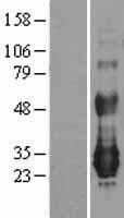 NFAM1 Protein (Over-Expression Lysate Myc-DDK (Flag))