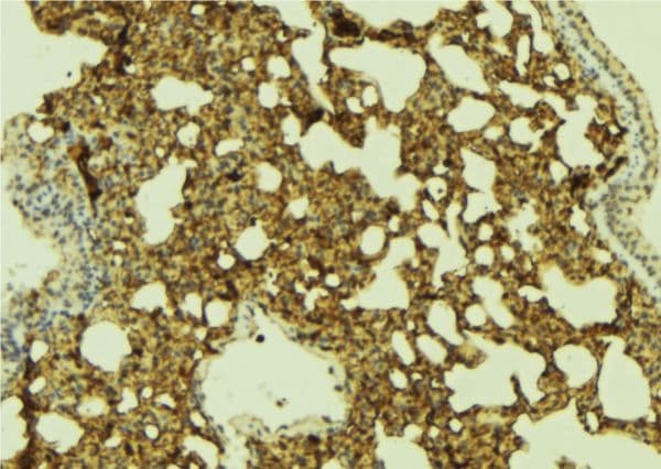 FOXO1 / FKHR Antibody
