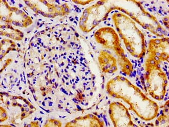 Polyclonal Rabbit anti-Human APOBEC3D Antibody (IHC)