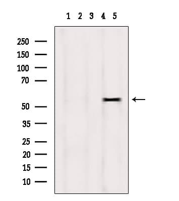 DPP4 / CD26 Antibody