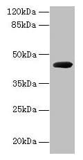 Polyclonal Rabbit anti-Pseudomonas cpg2 / Carboxypeptidase G2 Antibody (WB)