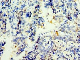 Trimethylguanosine Synthase 1 Antibody (aa714-853)