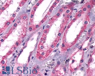 PathPlus™ Polyclonal Rabbit anti-Human ACKR3 / CXCR7 Antibody (Cytoplasmic Domain, IHC, WB)