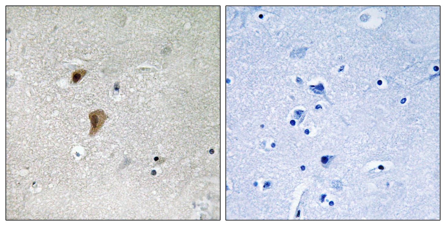 Polyclonal Rabbit anti-Human HSF1 Antibody (phospho-Thr142, IHC)
