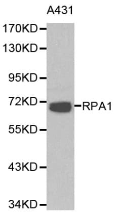 RPA70 / RPA1 Antibody