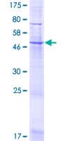 Human UNC50 Protein (Recombinant GST)