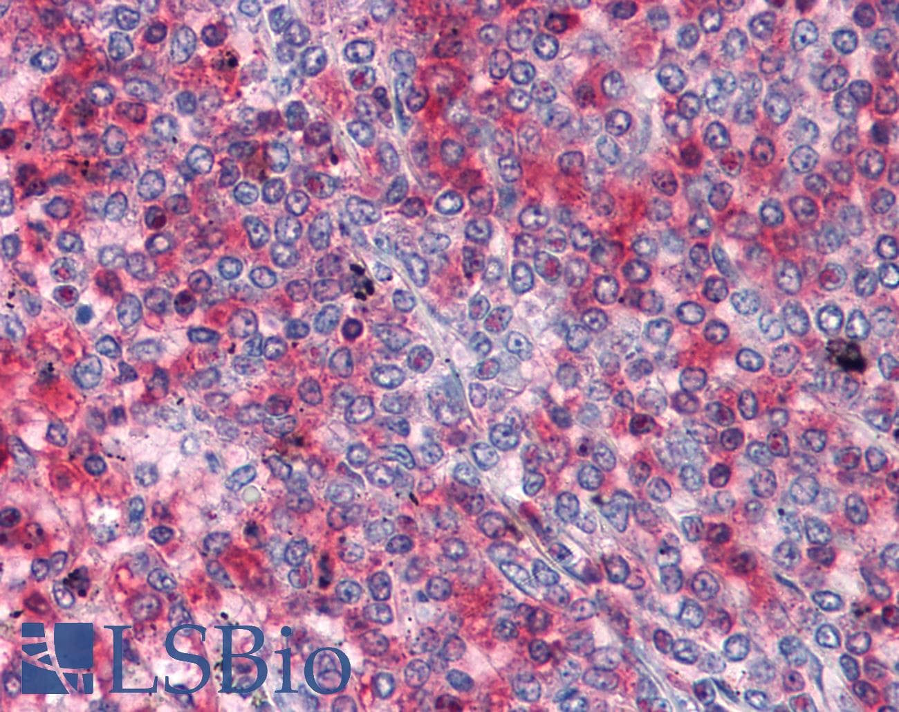 IHC-plus™ Monoclonal Mouse anti-Human RRM2 Antibody (clone 1E1, IHC, IF, WB)