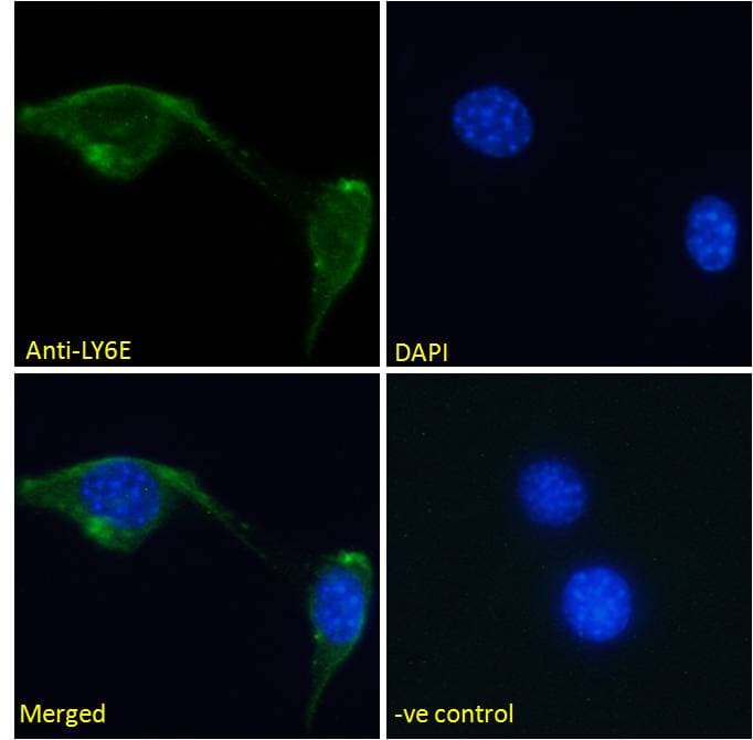 SCA2 / LY6E Antibody (aa46-56)