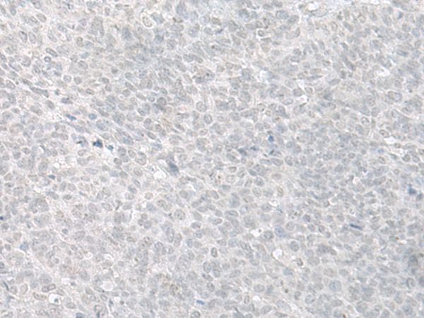 Polyclonal Rabbit anti-Human C8orf4 Antibody (IHC)
