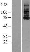 IRAK1 / IRAK Protein (Over-Expression Lysate Myc-DDK (Flag))