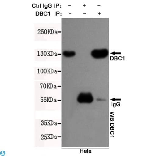 BRINP1 / DBC1 Antibody