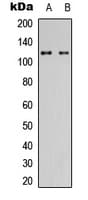 Polyclonal Rabbit anti-Human USP38 Antibody (Internal, WB)