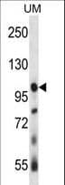 USP4 Antibody (aa1-30)