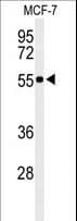 Polyclonal Rabbit anti-Human PRPF19 / PRP19 Antibody (aa4-33, IHC, WB)