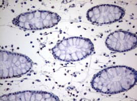 TIA-1 Antibody (clone OTI1D7)