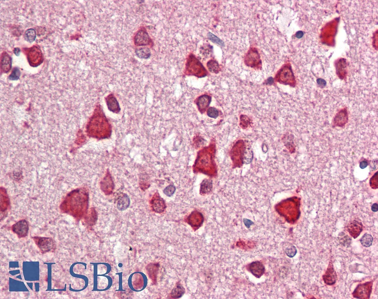 IHC-plus™ Polyclonal Rabbit anti-Human CRIM1 Antibody (IHC, IF, WB)