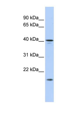 Polyclonal Rabbit anti-Human SLAIN1 Antibody (aa221-270, WB)