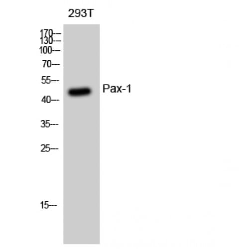 PAX1 Antibody (Internal)