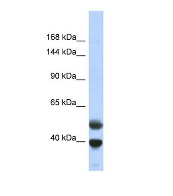 Polyclonal Rabbit anti-Human PRDM7 Antibody (N-Terminus, WB)