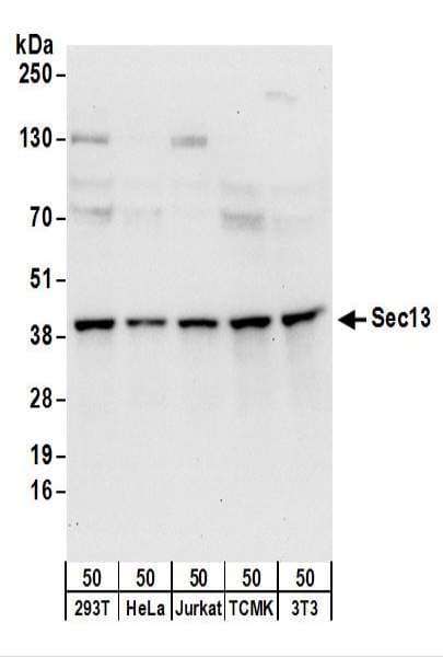 IHC-plus™ SEC13 Antibody (aa270-320)
