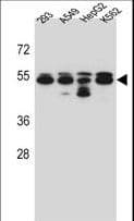 TUBB8 / Tubulin Beta 8 Antibody (aa34-62)