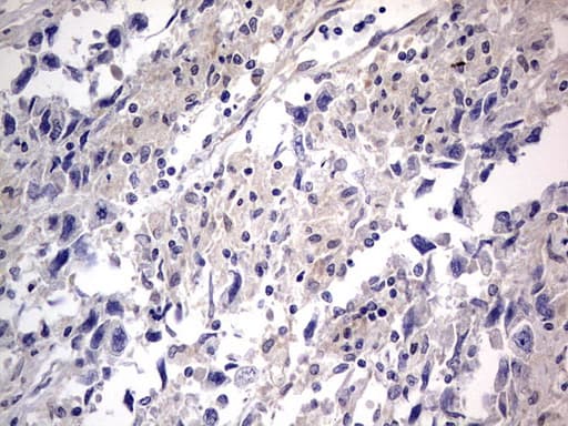 PRX-1 / PRRX1 Antibody (clone OTI1E10)