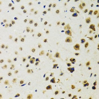 TIP48 / RUVBL2 Antibody