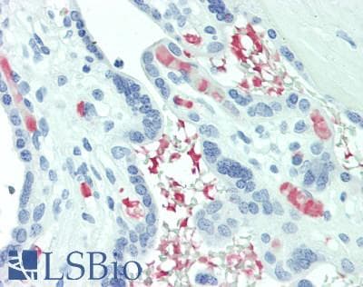 ABHD12B Antibody (C-Terminus)