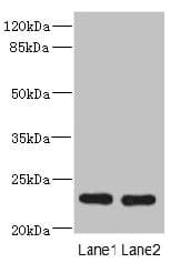 Polyclonal Rabbit anti-Human RAB17 Antibody (IHC, WB)
