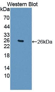 LGALS12 / Galectin 12 Antibody (aa119-311)