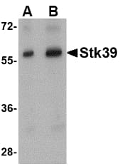 STK39 / SPAK Antibody