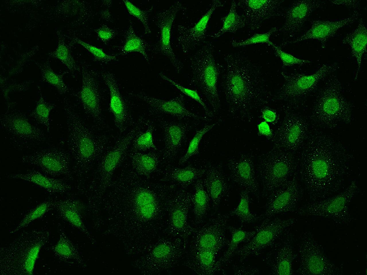 Polyclonal Rabbit anti-Human APBB1 / FE65 Antibody (IHC, IF)