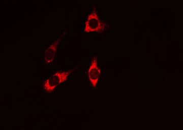 Polyclonal Rabbit anti-Human PIK3R1 / p85 Alpha Antibody (IHC, IF, WB)