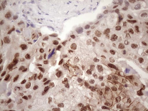 IKBKE / IKKI / IKKE Antibody (aa474-716, clone OTI3C5)