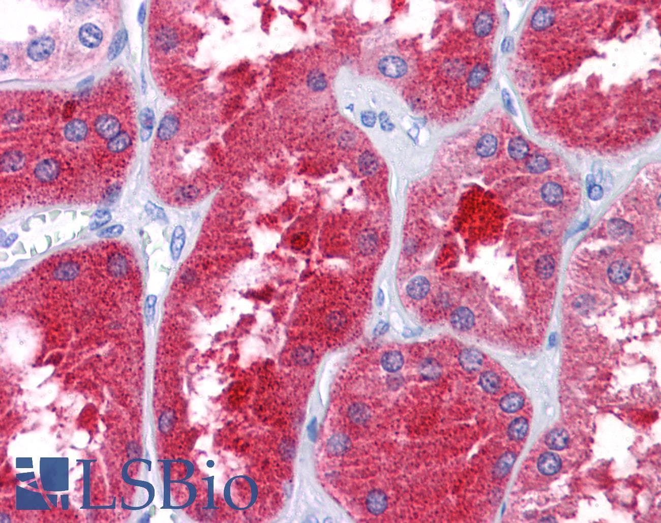 IHC-plus™ Polyclonal Rabbit anti-Human REEP3 Antibody (IHC, IF, WB)