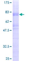 Human MATH2 / NEUROD6 Protein (Recombinant GST)