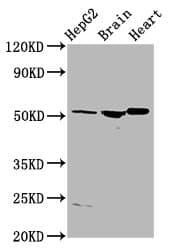AGT / Angiotensinogen Antibody