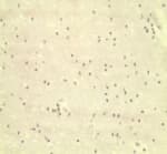 Polyclonal Rabbit anti-Human LY96 / MD2 / MD-2 Antibody (IHC, WB)