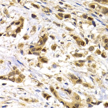 MAGEA1 / MAGE 1 Antibody