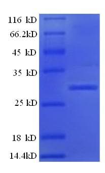 Rat KLKB1 / Plasma Kallikrein Protein (Recombinant 6His, N-terminus)