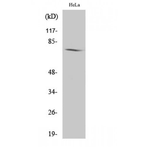 AMPH / Amphiphysin Antibody (100-180 aa, Internal)