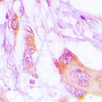 MARK1+2+3+4 Antibody (Internal)
