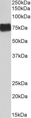PathPlus™ FGA / Fibrinogen Alpha Antibody