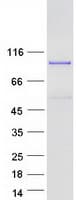 Human MED25 Protein (Recombinant Myc-DDK (Flag))