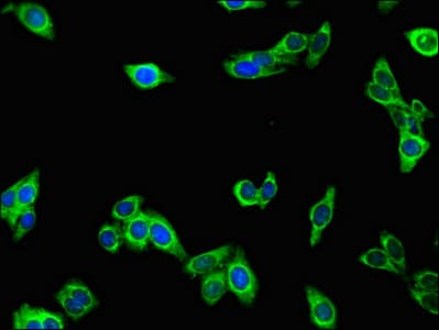 Mannose Phosphate Isomerase Antibody